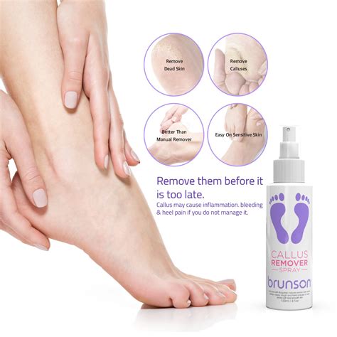 Achieve Baby-Soft Feet with the Nail and Callus Magic Remover